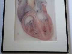 TED BLOODHART PAINTING POP ART HUMAN SCIENCE MEDICAL SURGICAL REALISM HEART 1970