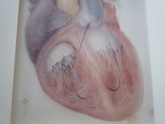 TED BLOODHART PAINTING POP ART HUMAN SCIENCE MEDICAL SURGICAL REALISM HEART 1970