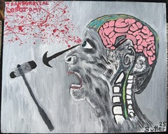Transorbital Lobotomy 8×10″ Canvas Board Painting Signed By Artist Leland Butler