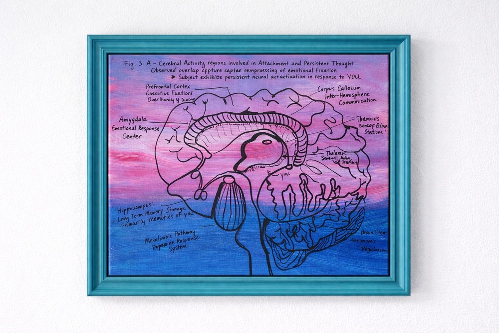 Anatomical Brain Art 11×14 Original Painting – Neuroscience Diagram Pop Surreal